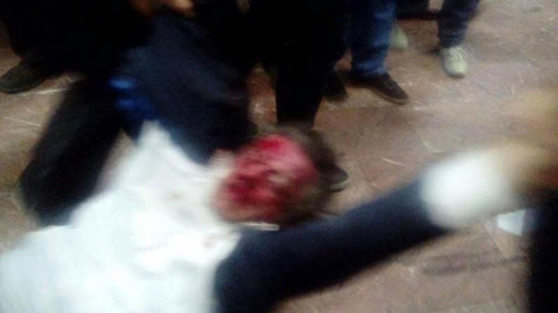 Демонстрантите го повредија и пратеникот Зијадин Села