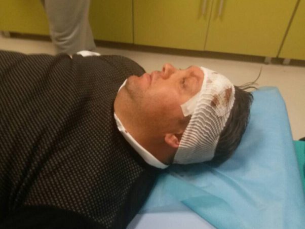СДСМ и ВМРО ДПМНЕ го осудија нападот врз Елвис Бајрам