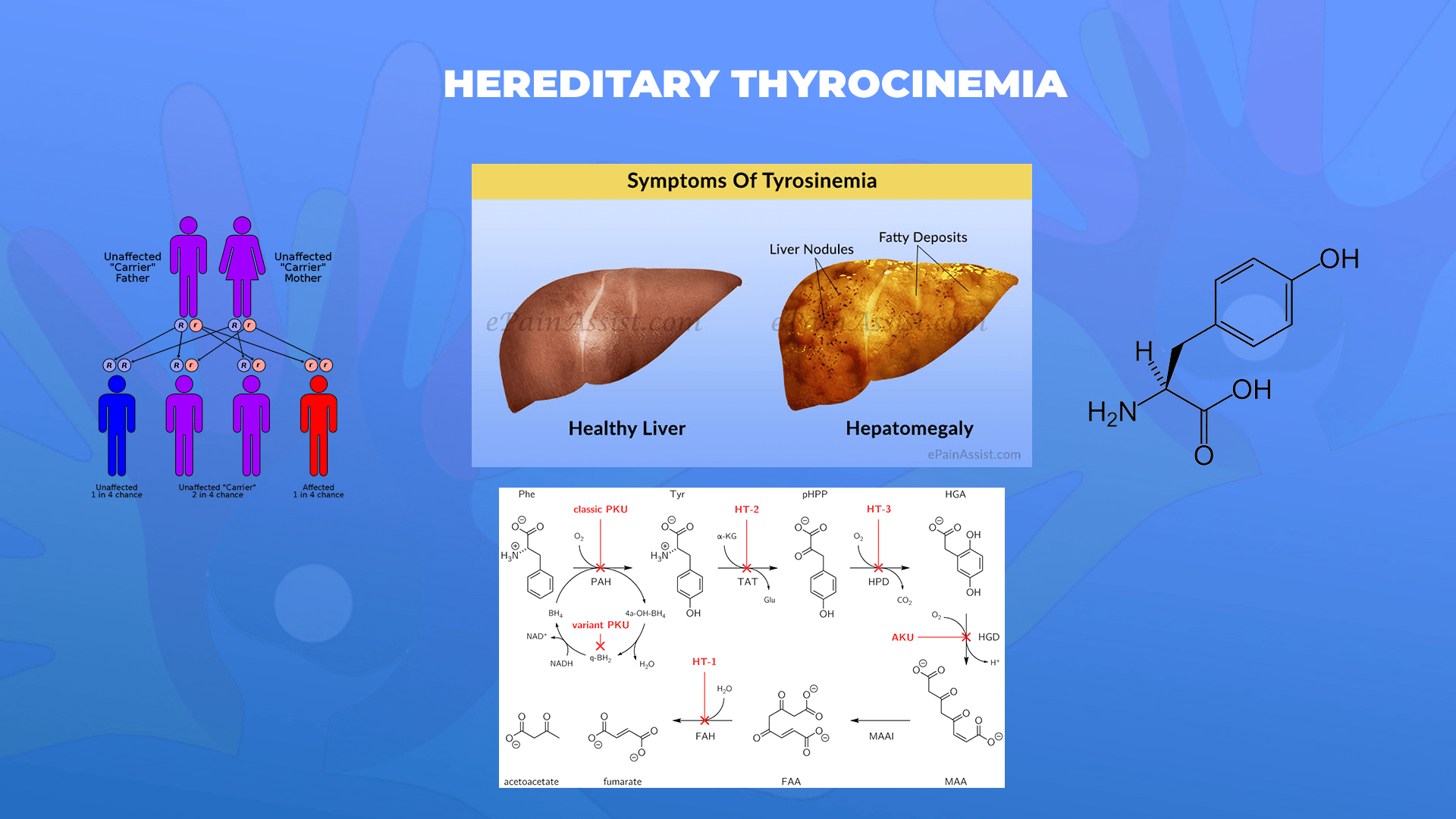 Ги запознаваме ретките болести: Наследна Тироцинемија – Hereditary Thyrocinemia