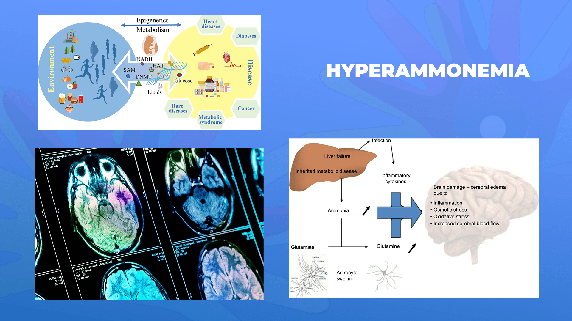 Ги запознаваме ретките болести: Хиперамонемија – Hyperammonemia
