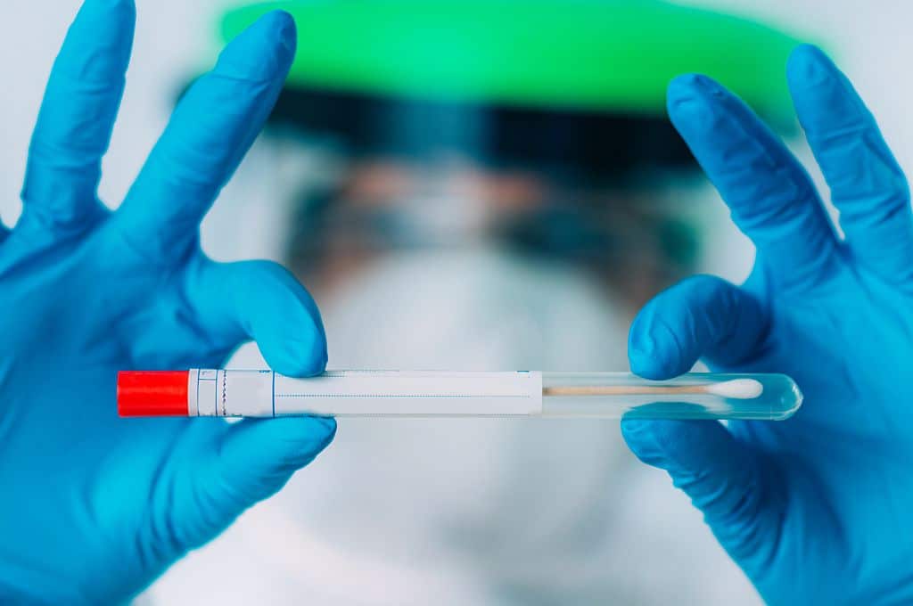 Вистиномер: ПЦР тестот за коронавирусот нема никаква врска со микрочипови