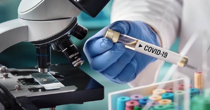 Регистрирани се 44 нови Ковид случаи од направени 543 тестови