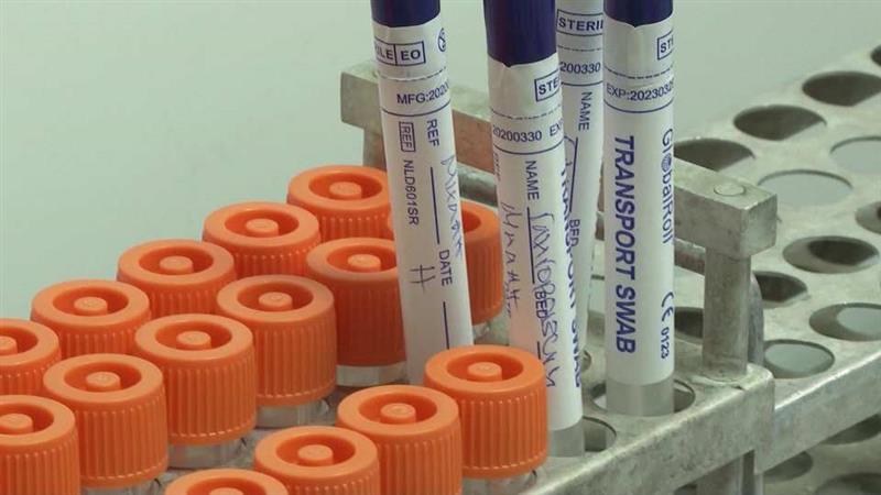 Почнува скрининг-тестирање за Ковид-19 за процена на имунитетот на населението